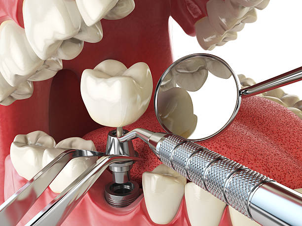 Best Urgent Dental Care in Woodlands, CA
